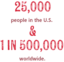 25,000 people in the U.S. & 1 in 500,000 worldwide